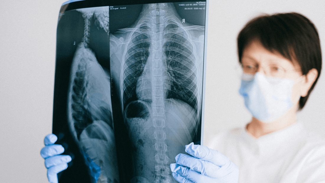 Doctor reviewing a coronary artery calcium (CAC) CT scan with a patient, explaining heart health results and calcium score test findings.