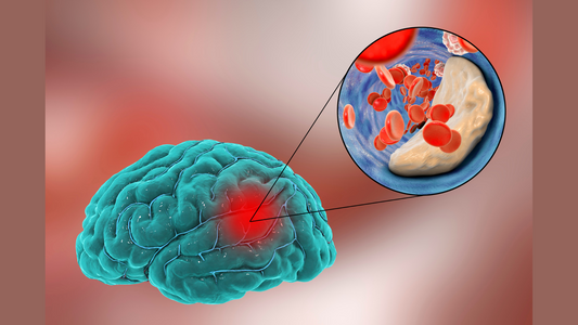 Conquering Cerebral Atherosclerosis: A Natural Approach
