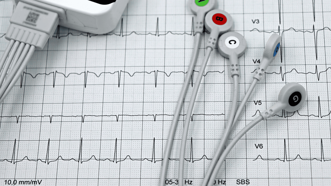 AFib Awareness Month: Understanding Heart Rhythm, Circulation, and Cardiovascular Wellness