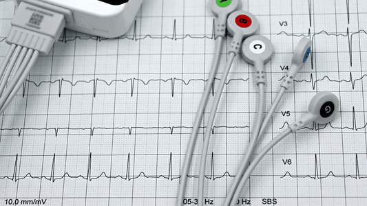 AFib Awareness Month: Understanding Heart Rhythm, Circulation, and Cardiovascular Wellness