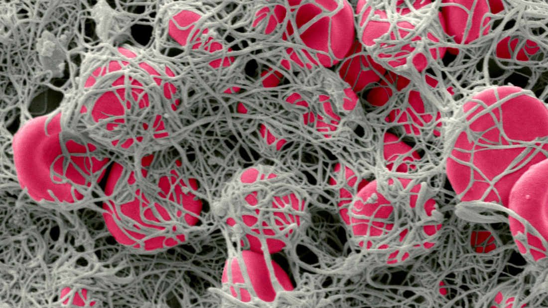 What Is Fibrin, and Why Does It Matter for Healthy Circulation?
