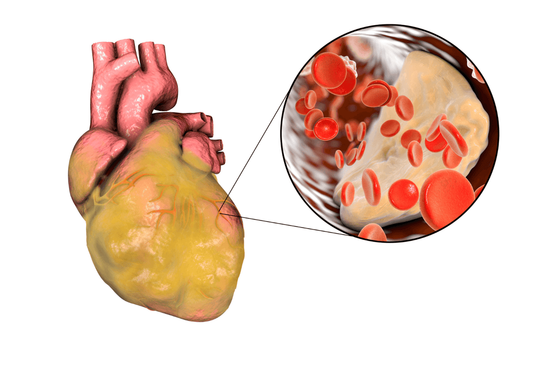 What Mike Woods Reveals About Removing Heart Plaque Naturally on the Well to Do Podcast