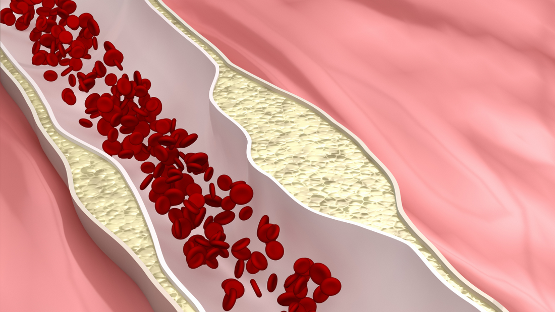 Coronary Calcification Treatment Options