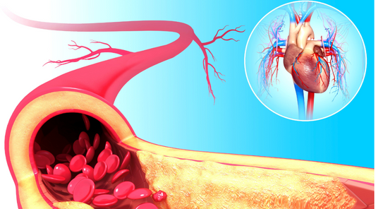 How Often Should We Have a Calcium Score Test?