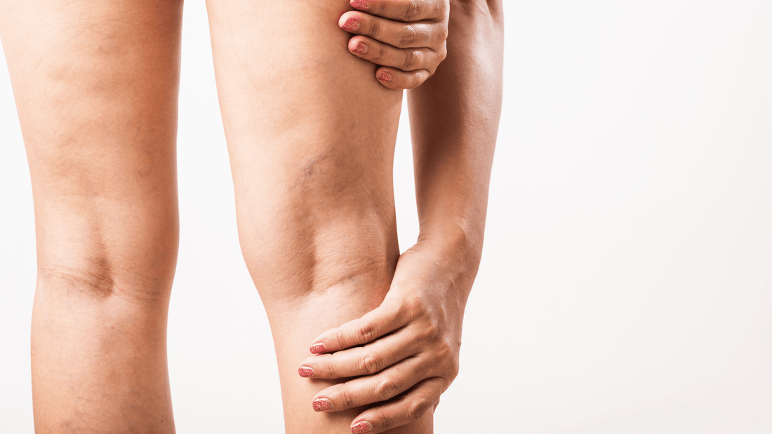 National Peripheral Artery Disease (PAD) Awareness Month: Understanding the Link Between Circulation and Heart Health