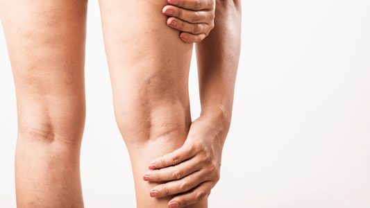 National Peripheral Artery Disease (PAD) Awareness Month: Understanding the Link Between Circulation and Heart Health